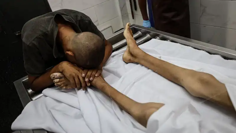 Gazze’nin Kayıp Nesli: Açlık ve Umutsuzluk İçinde Bir Çocuk Daha Hayata Veda Etti