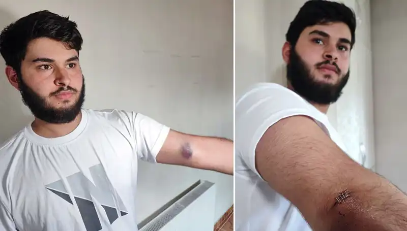 Bahçeye Kaçan Top, Mahallede Büyük Bir Kargaşaya Neden Oldu!